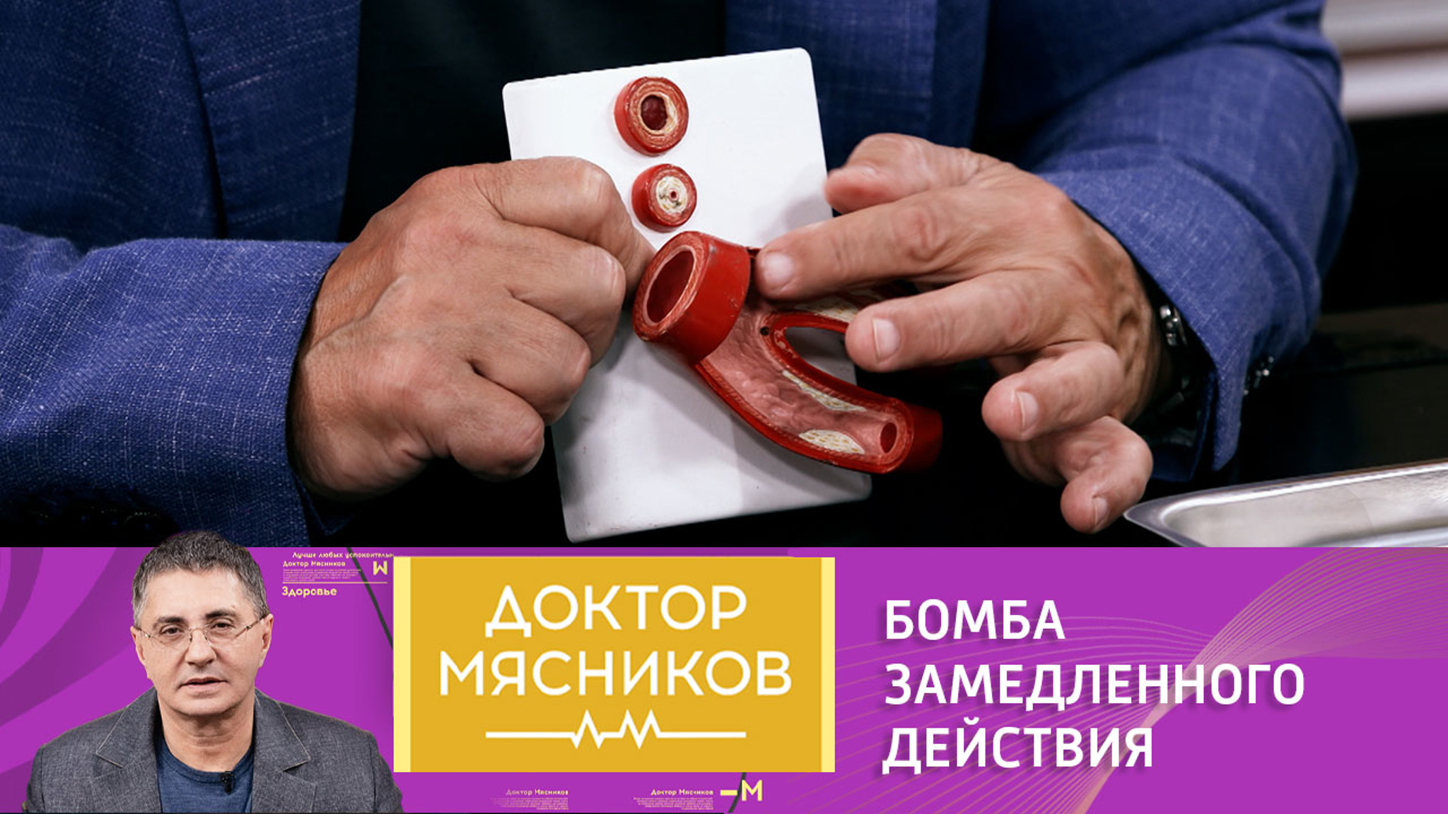 Что принимать для профилактики тромбоза