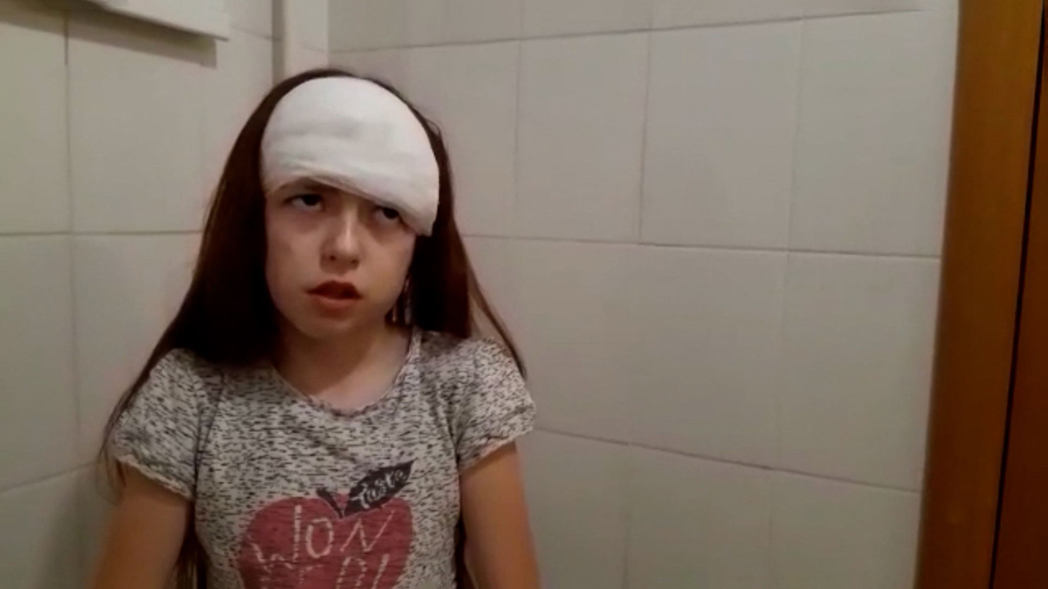 В Башкирии собака изувечила 10-летнюю девочку