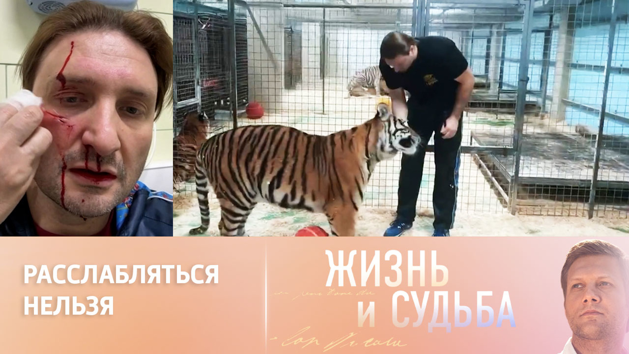 Почему тигр напал на Эдгарда Запашного