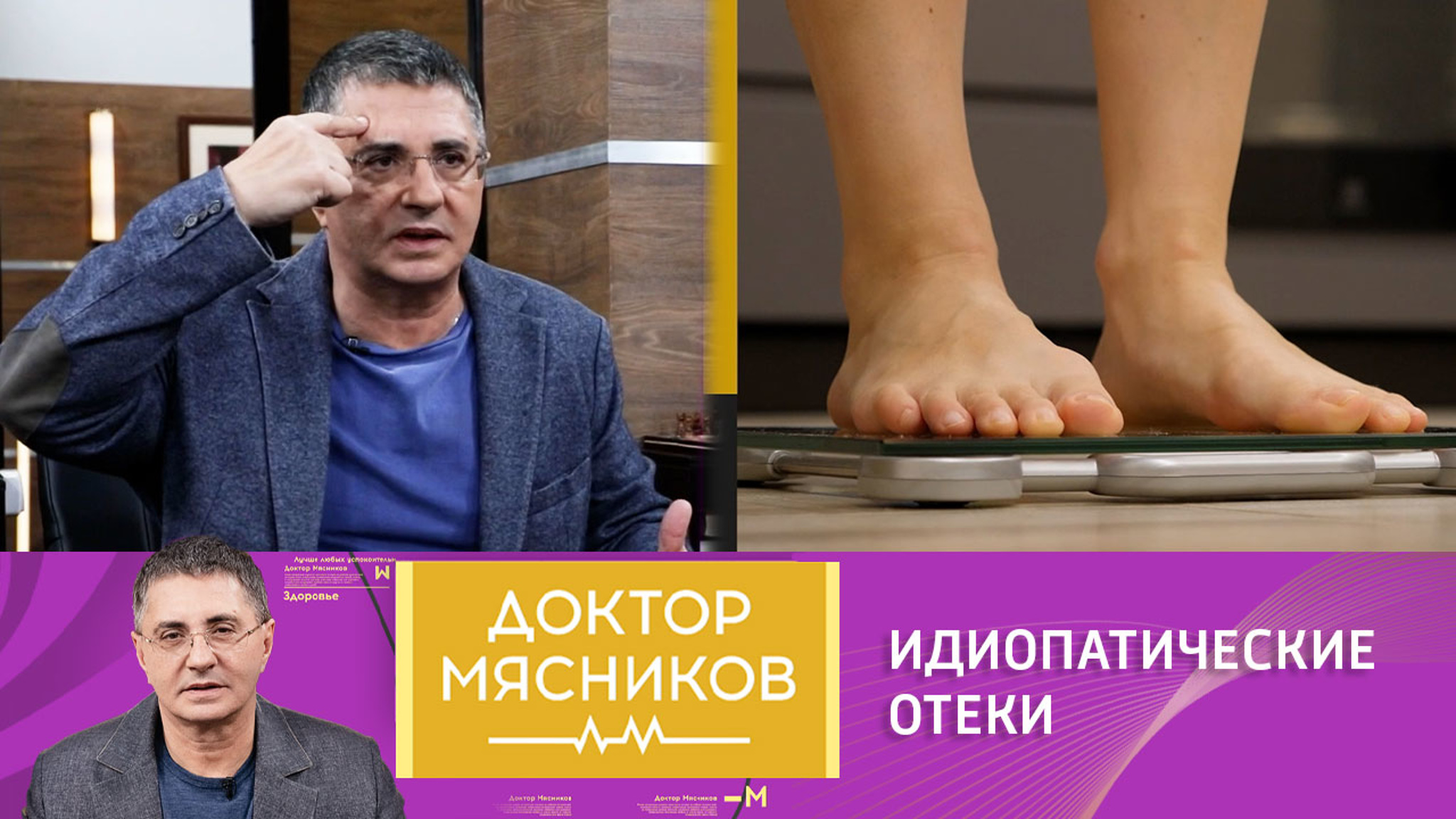 Почему могут отекать ноги у здорового человека