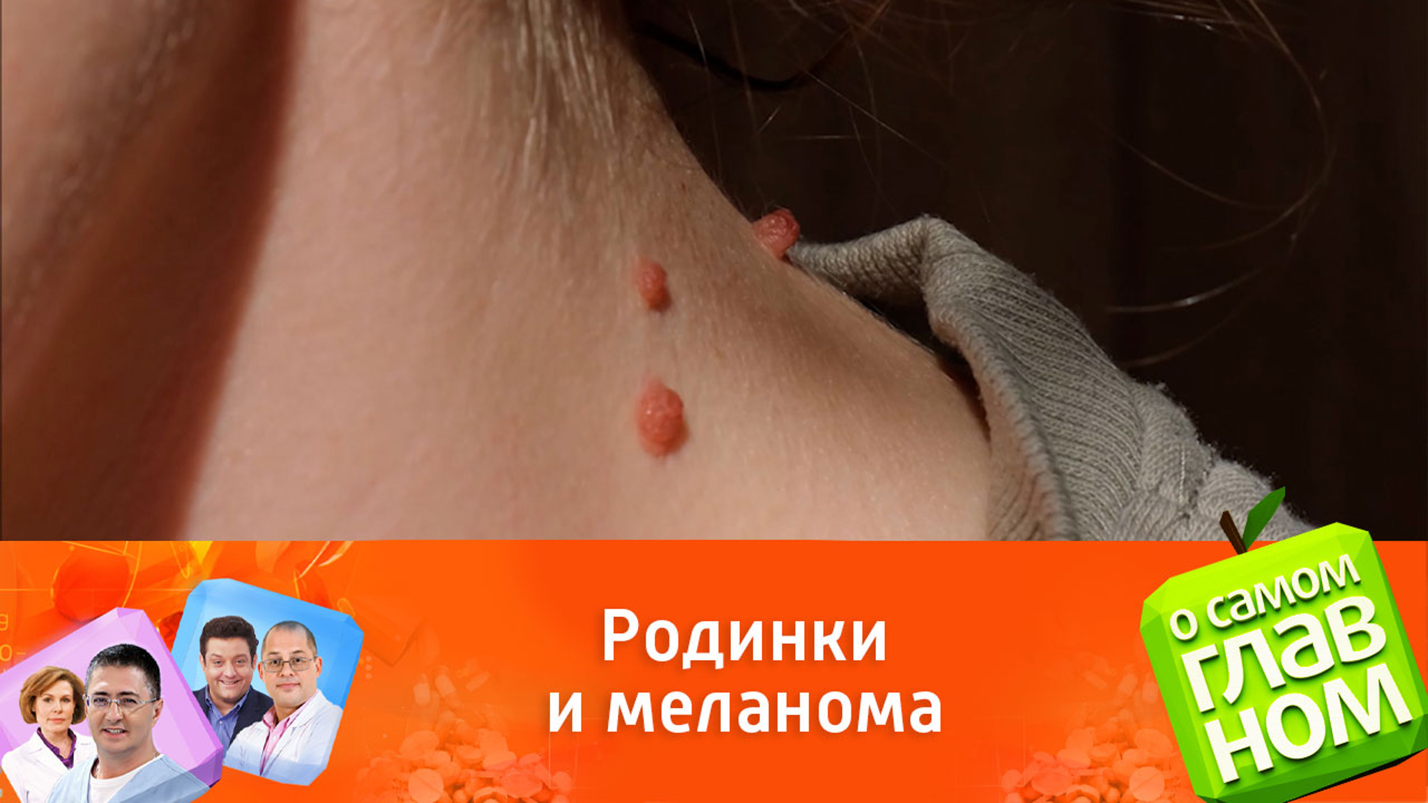 Мясников рассказал о меланоме и других заболевания кожи
