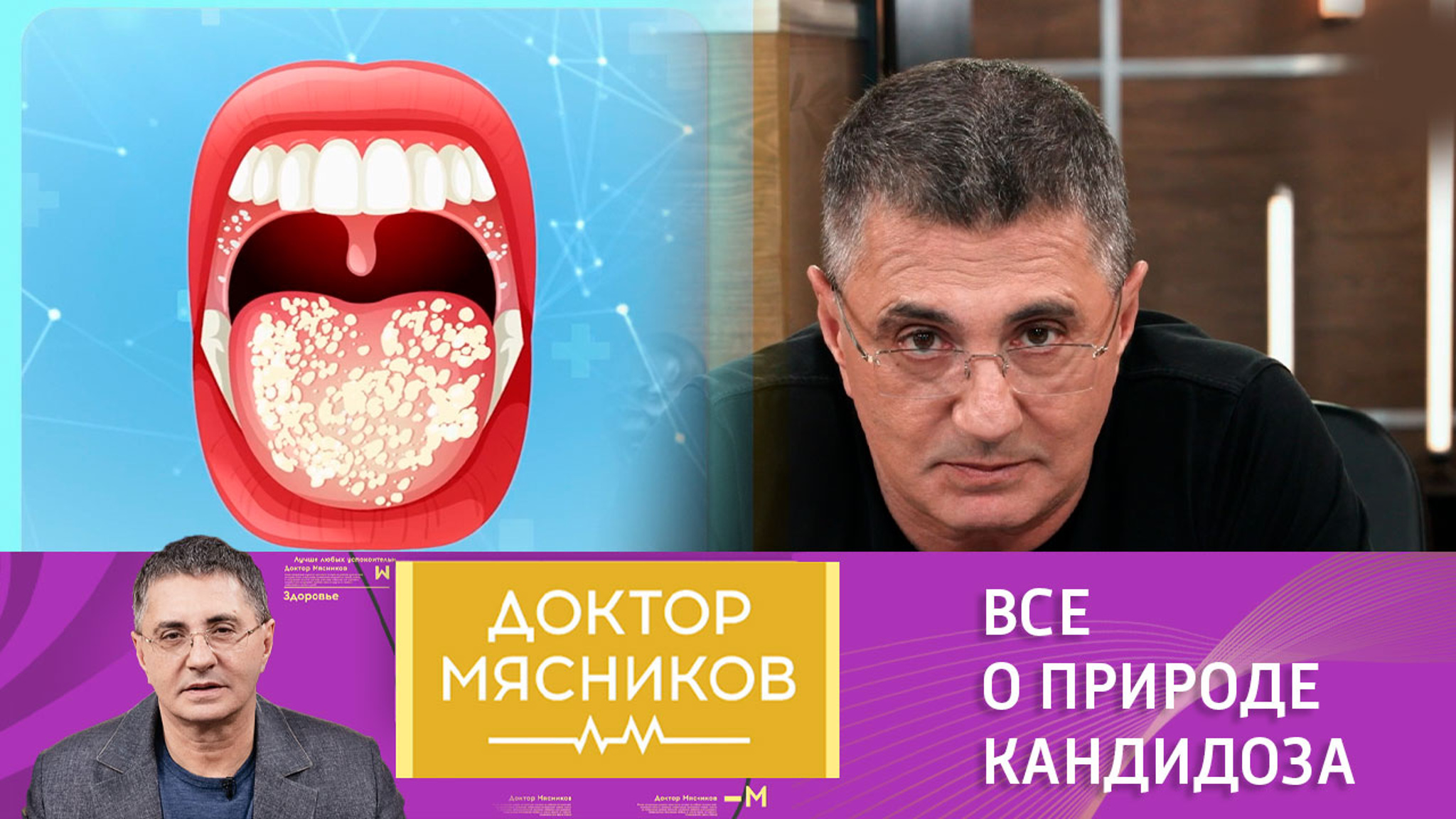 Актуальная тема: кандидоз