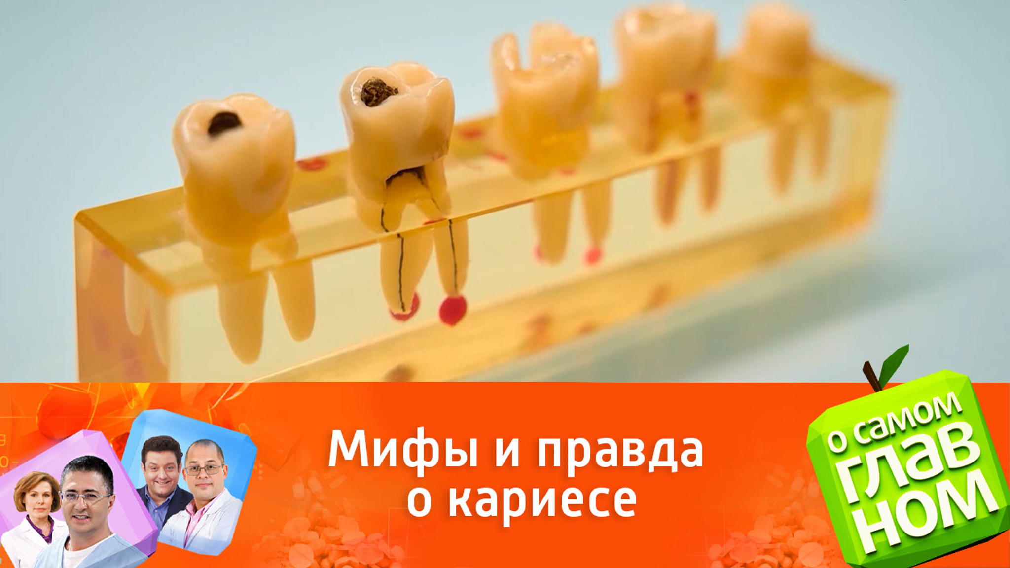 Что такое кариес и как он возникает