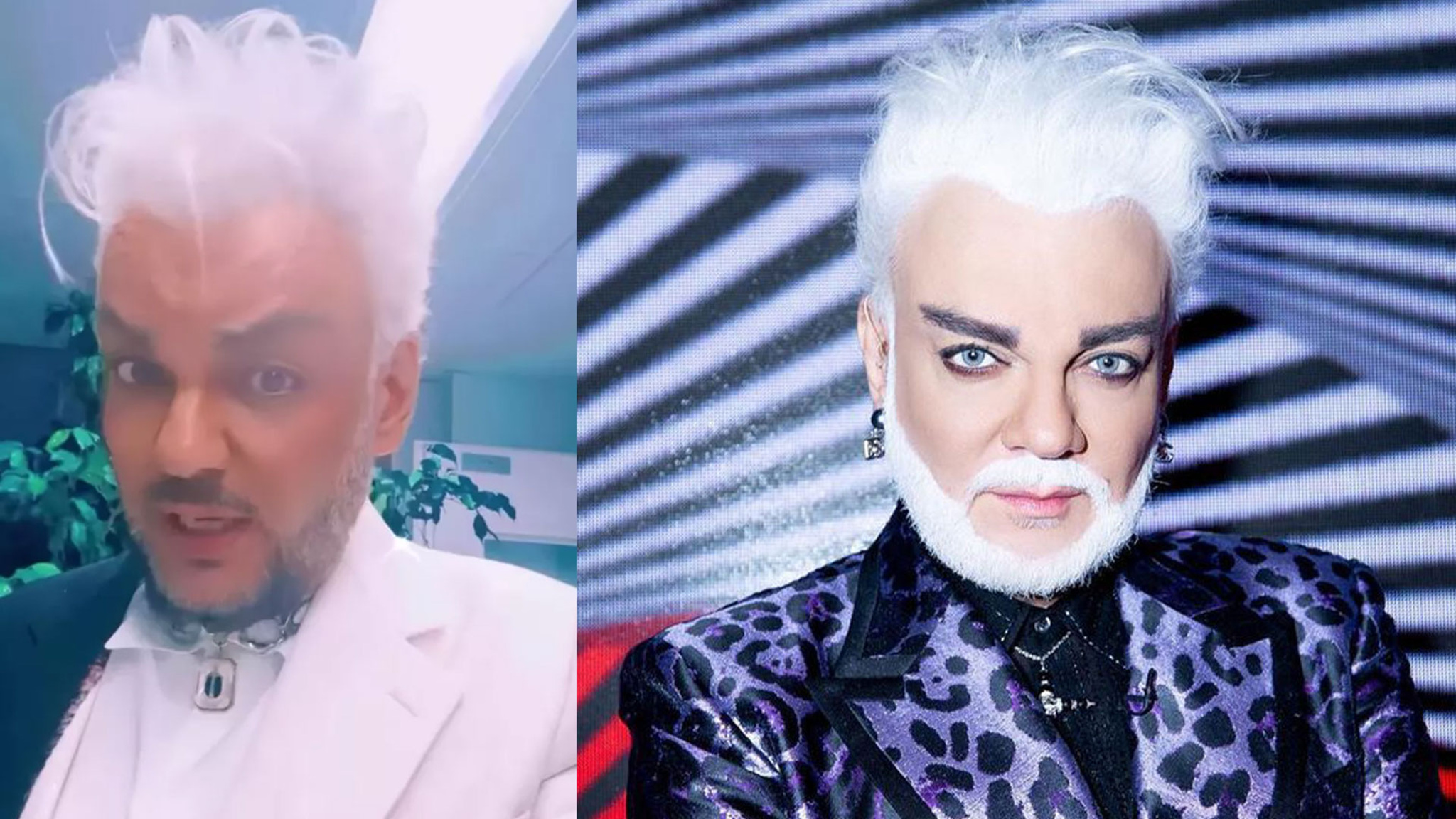 "Предела красоте и совершенству нет": Филипп Киркоров кардинально меняет образ