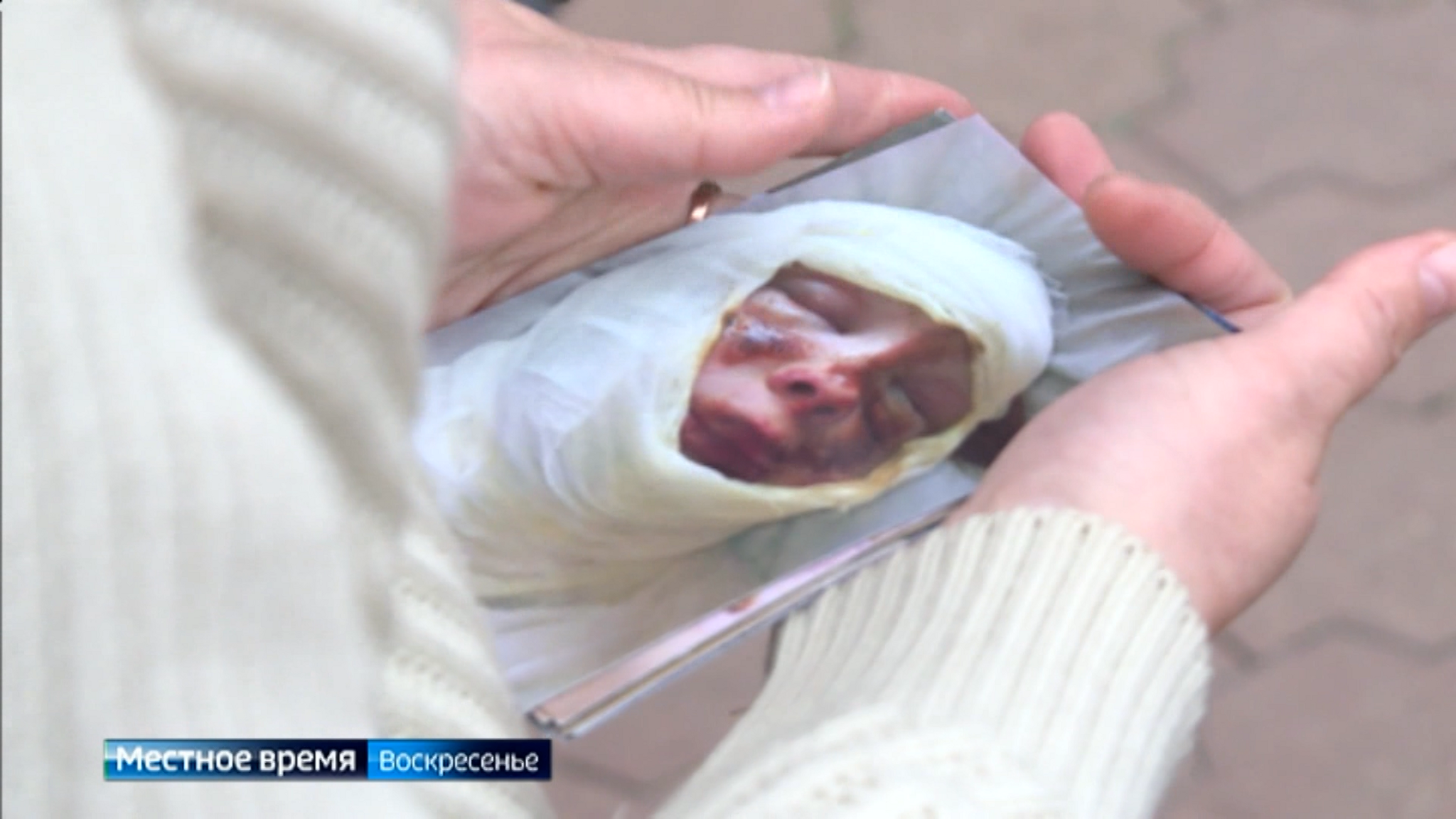 Ищут справедливости родители пострадавших детей в научно-развлекательном центре "Гравитация"