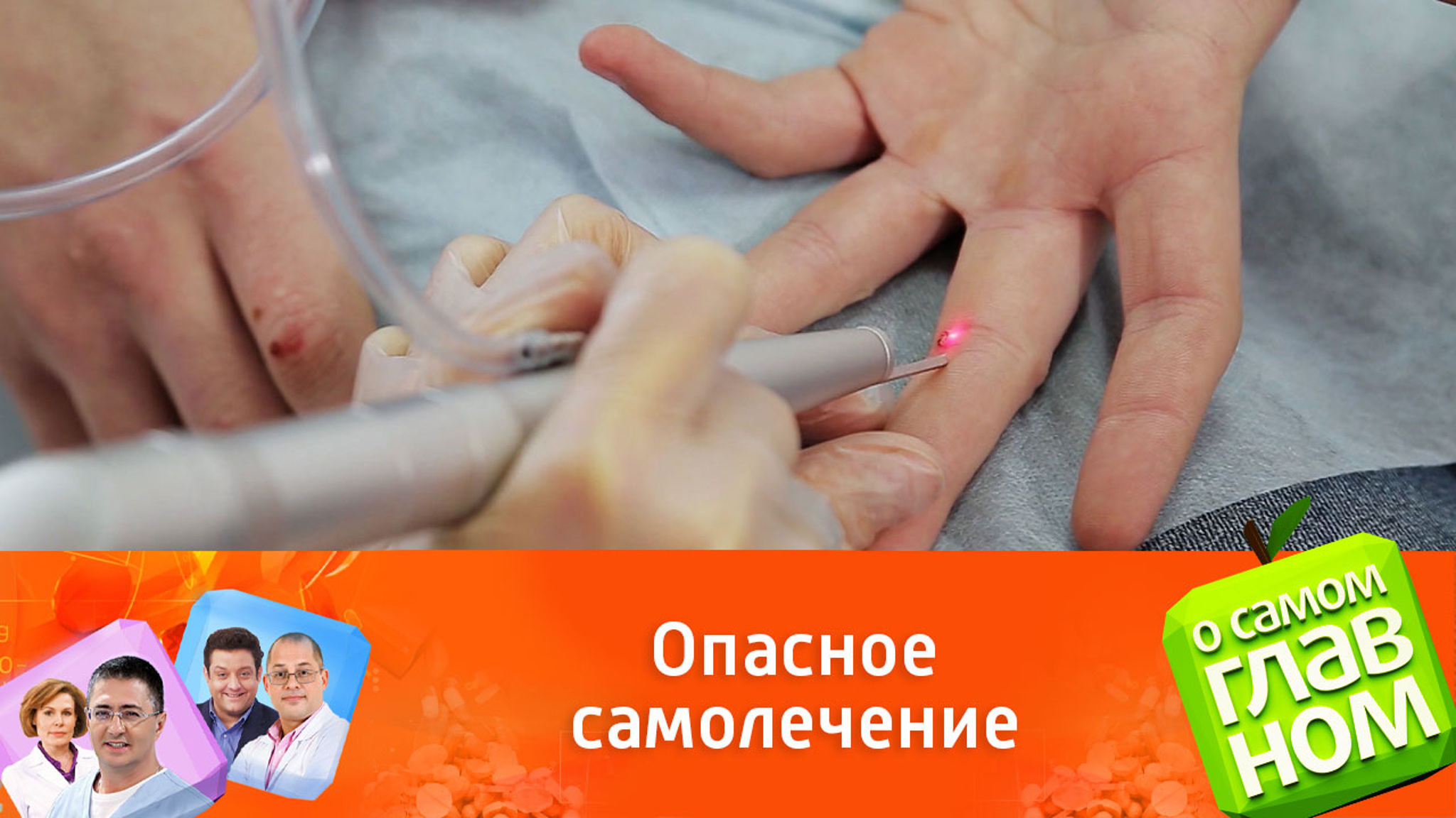 Почему нельзя удалять папилломы народными средствами