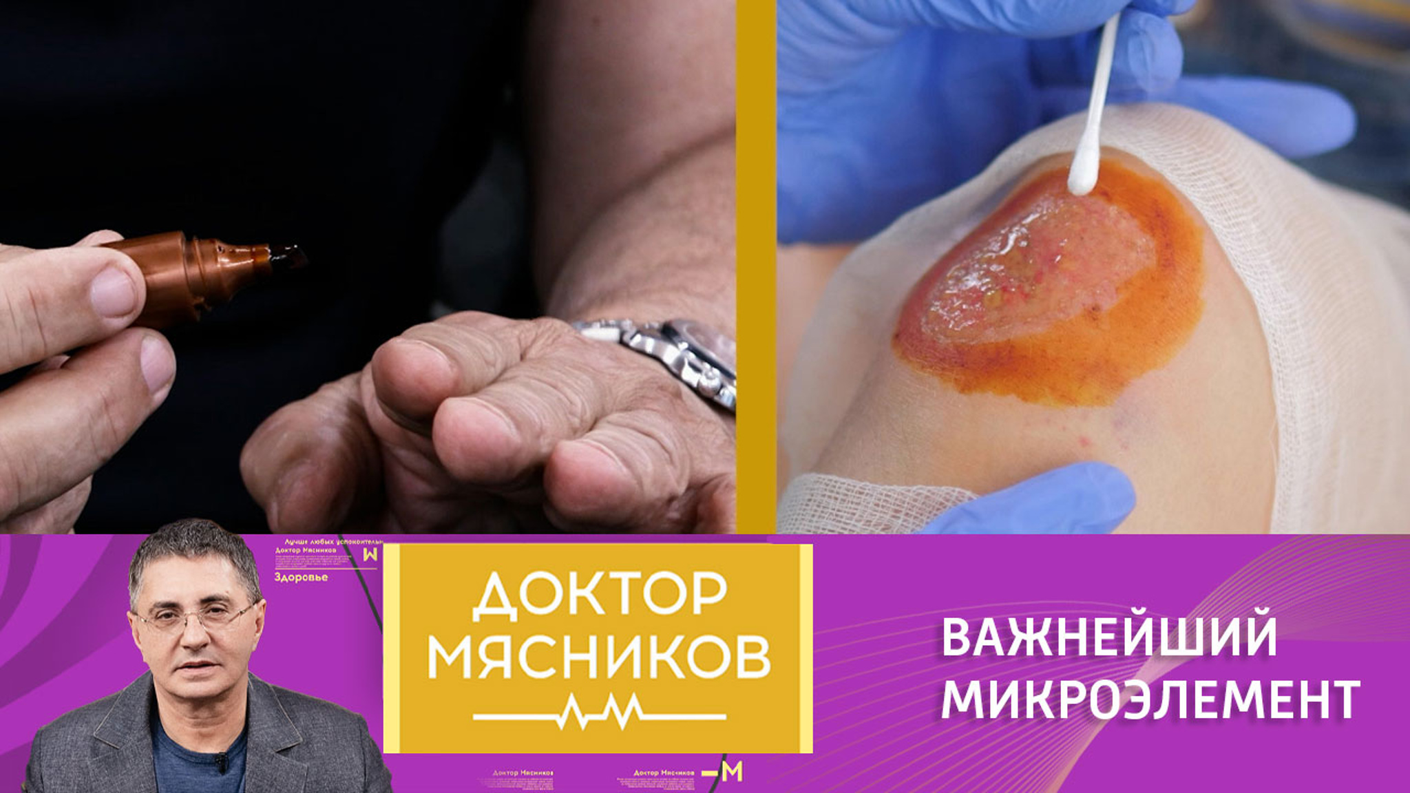 Опасен ли дефицит йода и как его восполнить