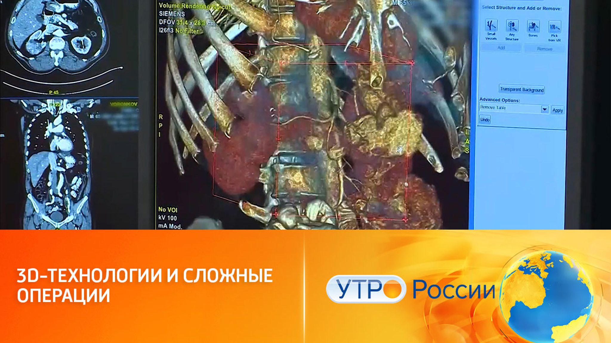 Оцифровка органов