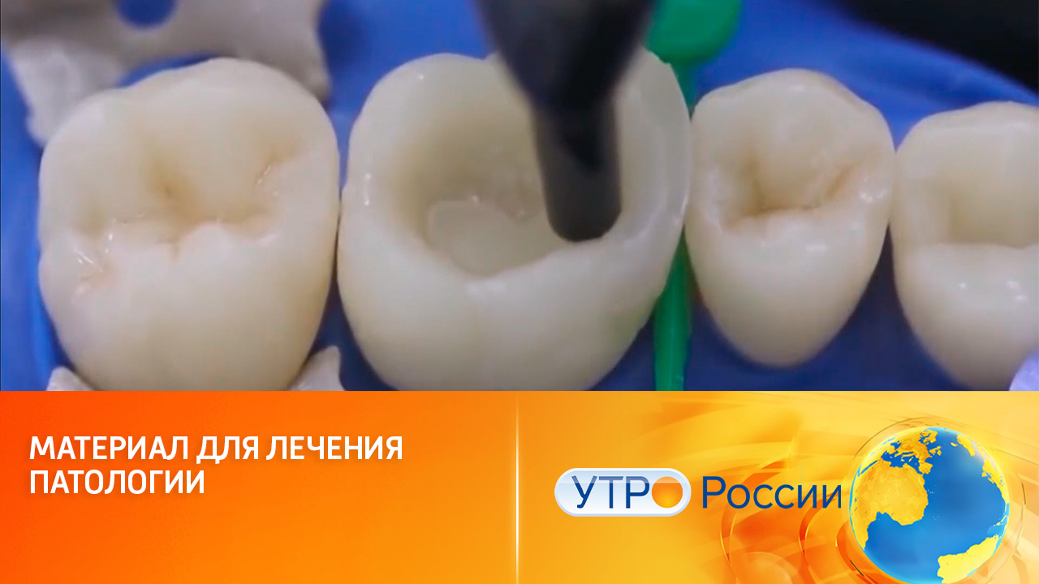 Гель для зубов