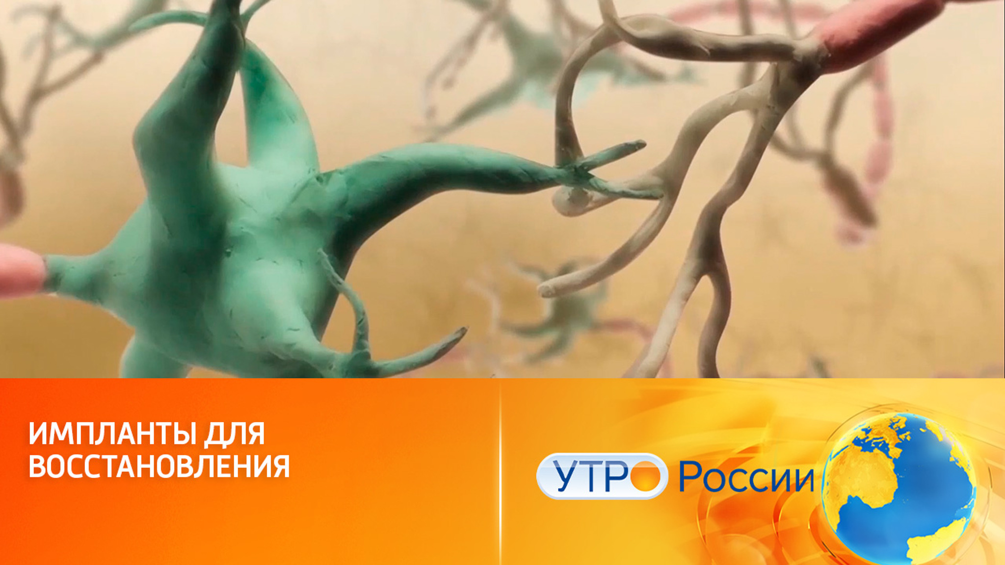 Нервные клетки