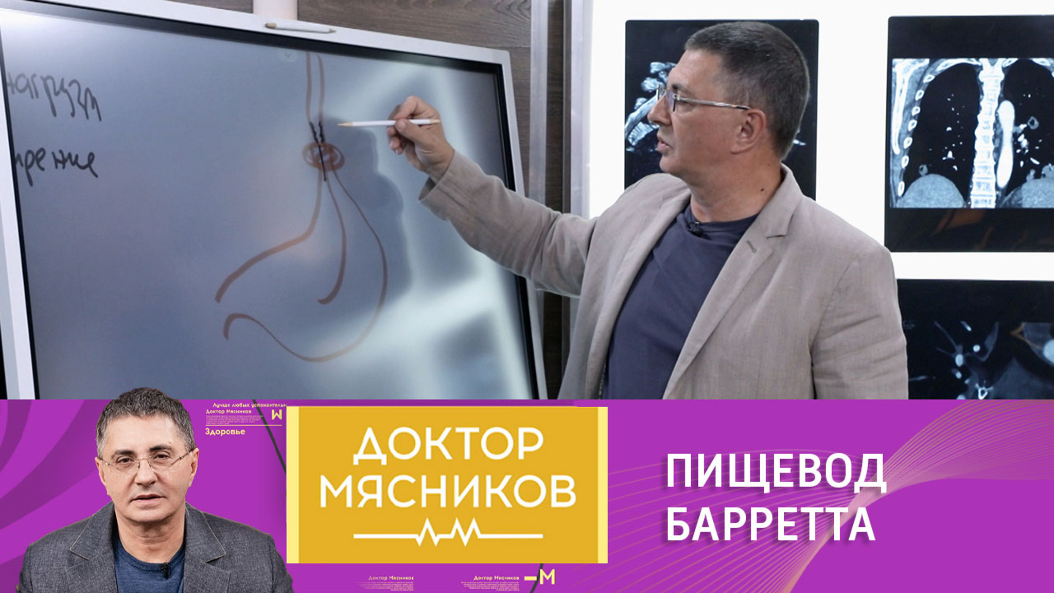 Почему опасно игнорировать изжогу