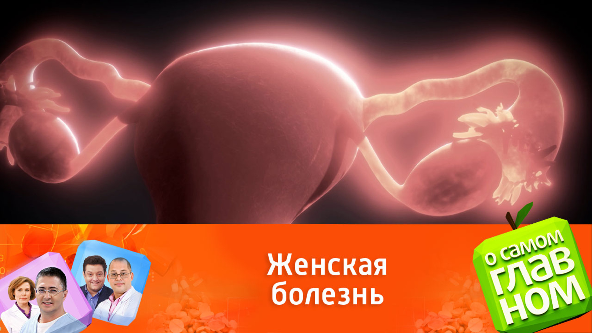 Что важно знать об эндометриозе