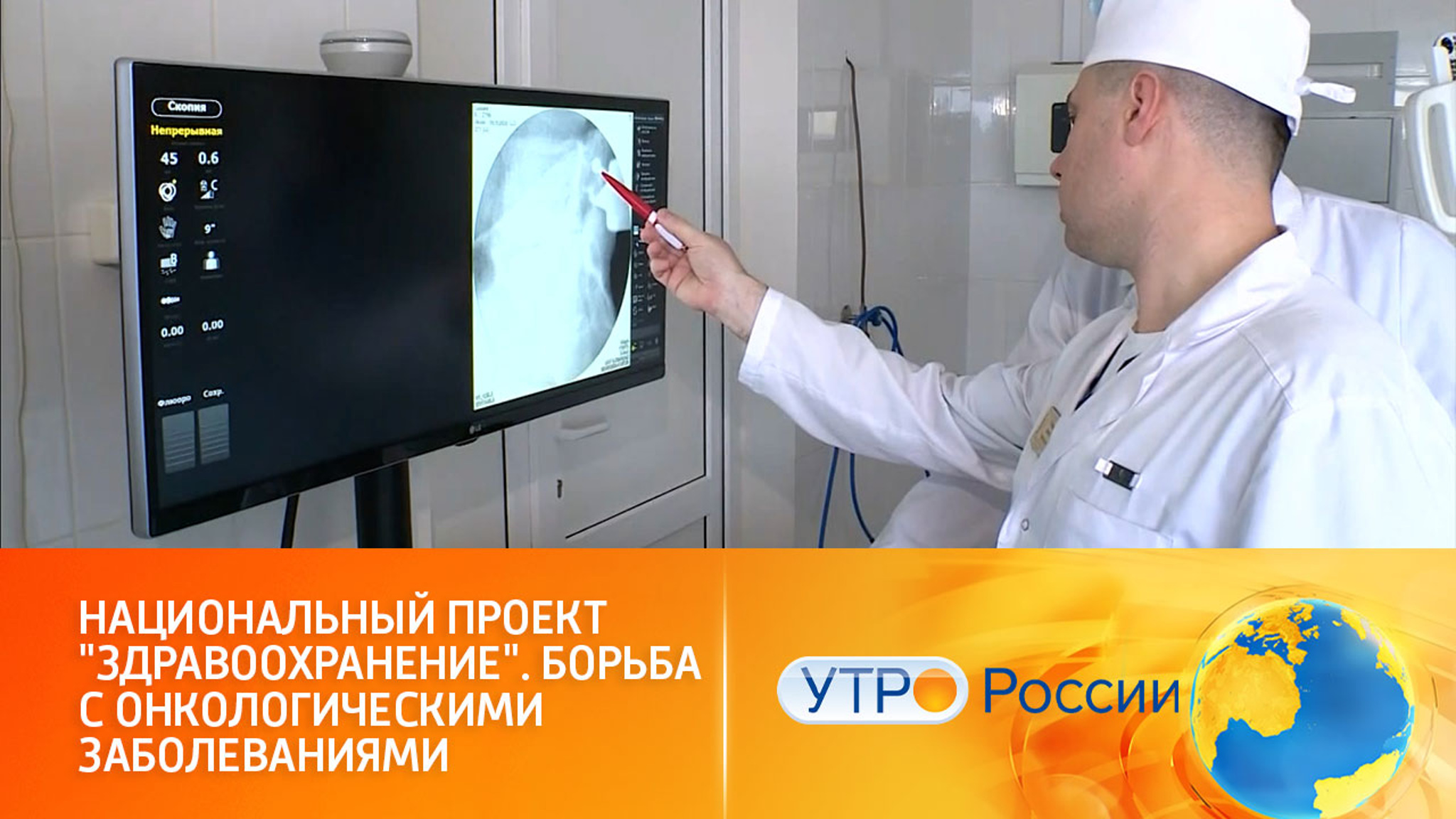 Выявление онкологических заболеваний на ранней стадии