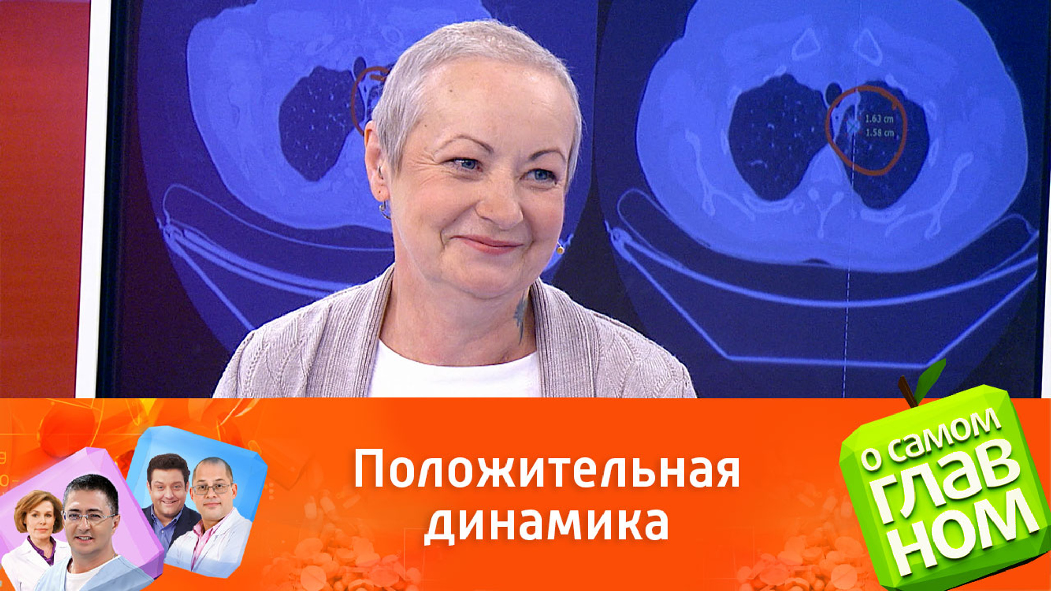 Телезрительница поделилась личным опытом борьбы с раком