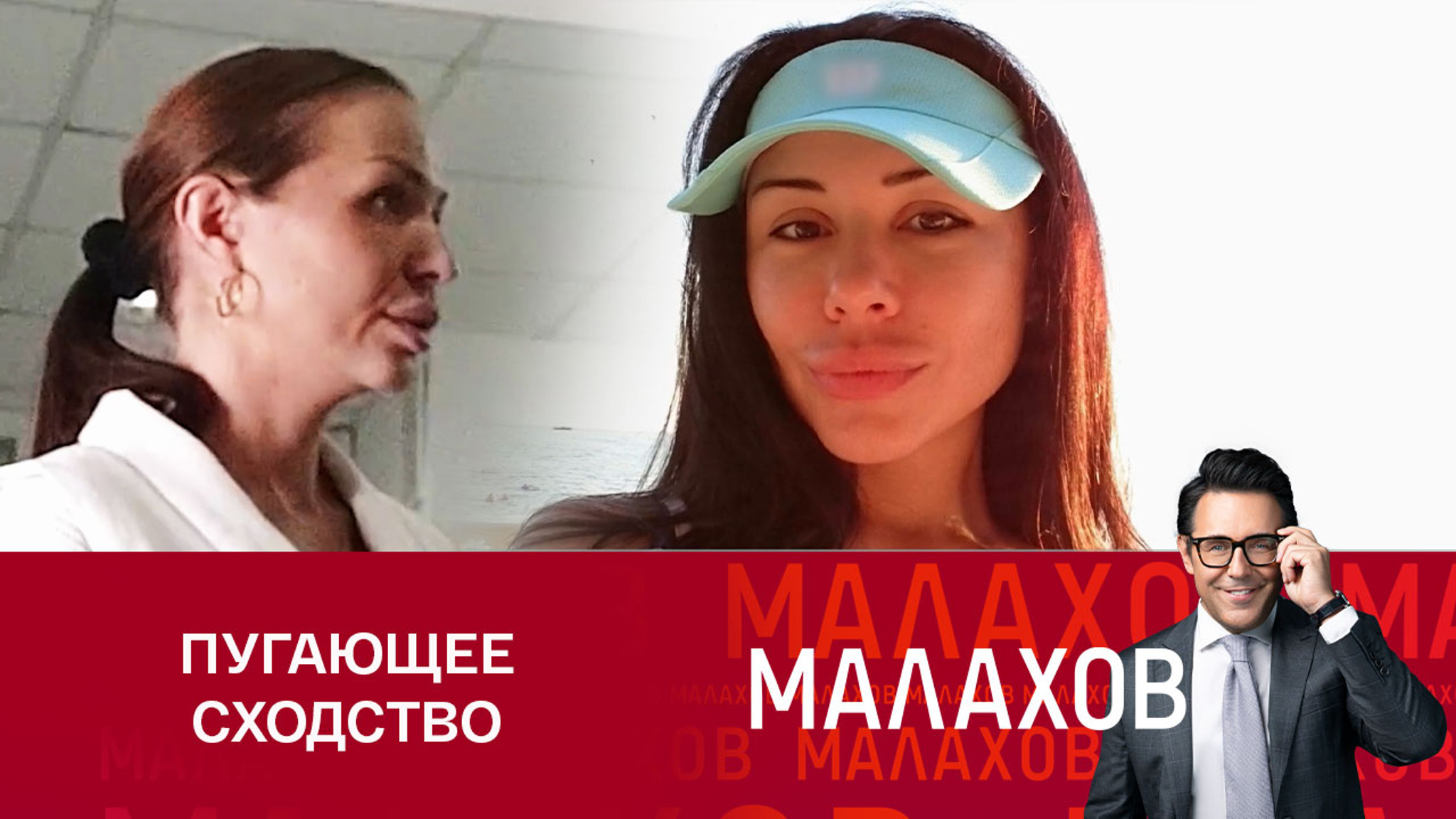 В Ереване обнаружили девушку, невероятно похожую на хирурга-самоучку Верди