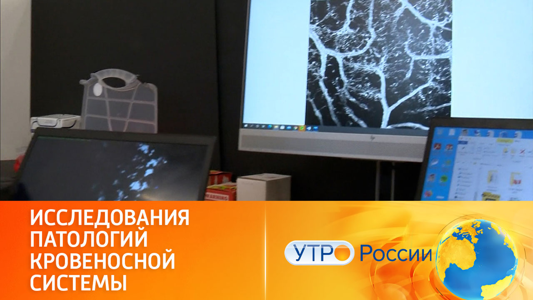 Сканирование сосудов