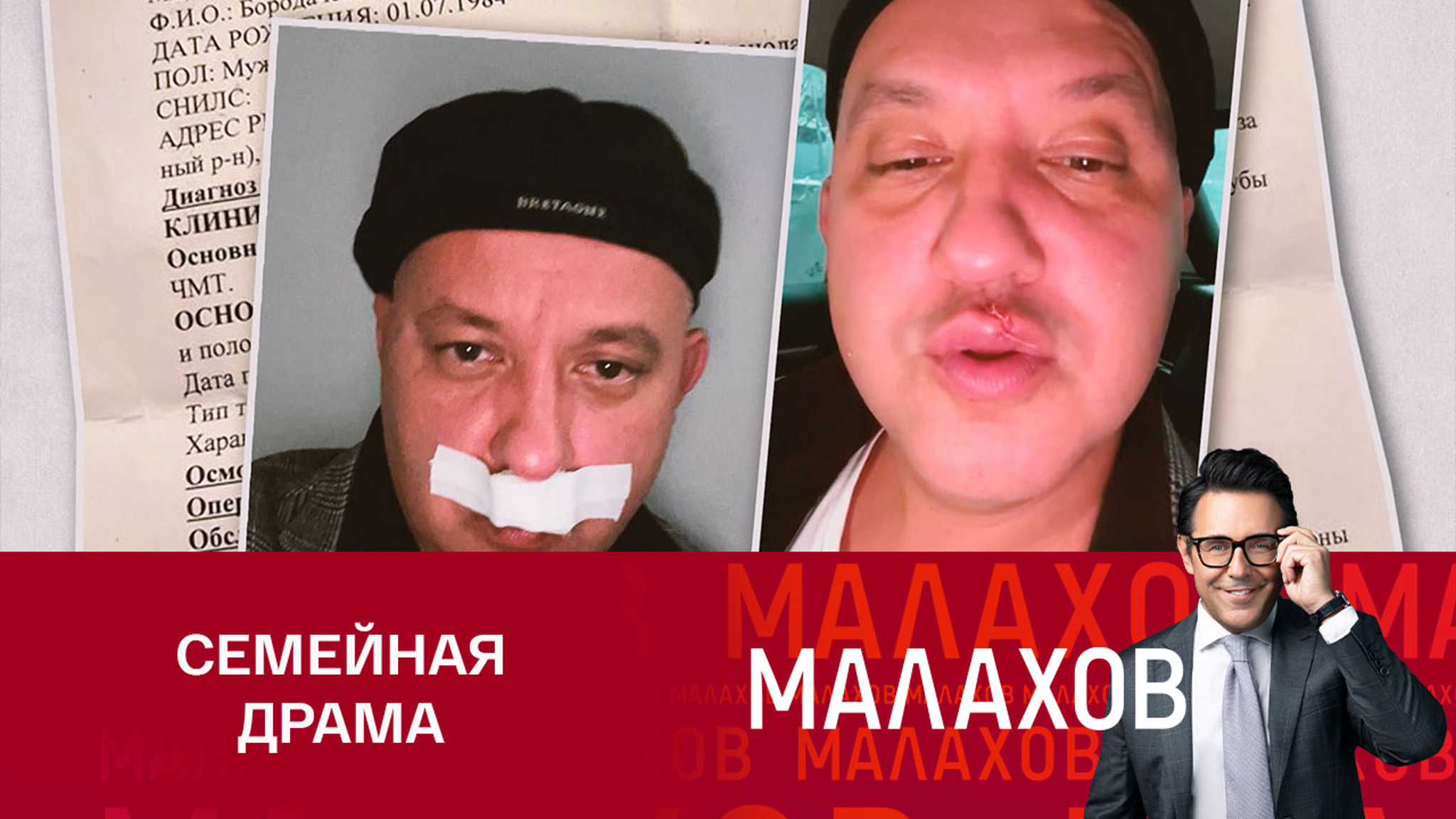 Мужчина о нападении бывшей жены и тещи: "Я не сопротивлялся"