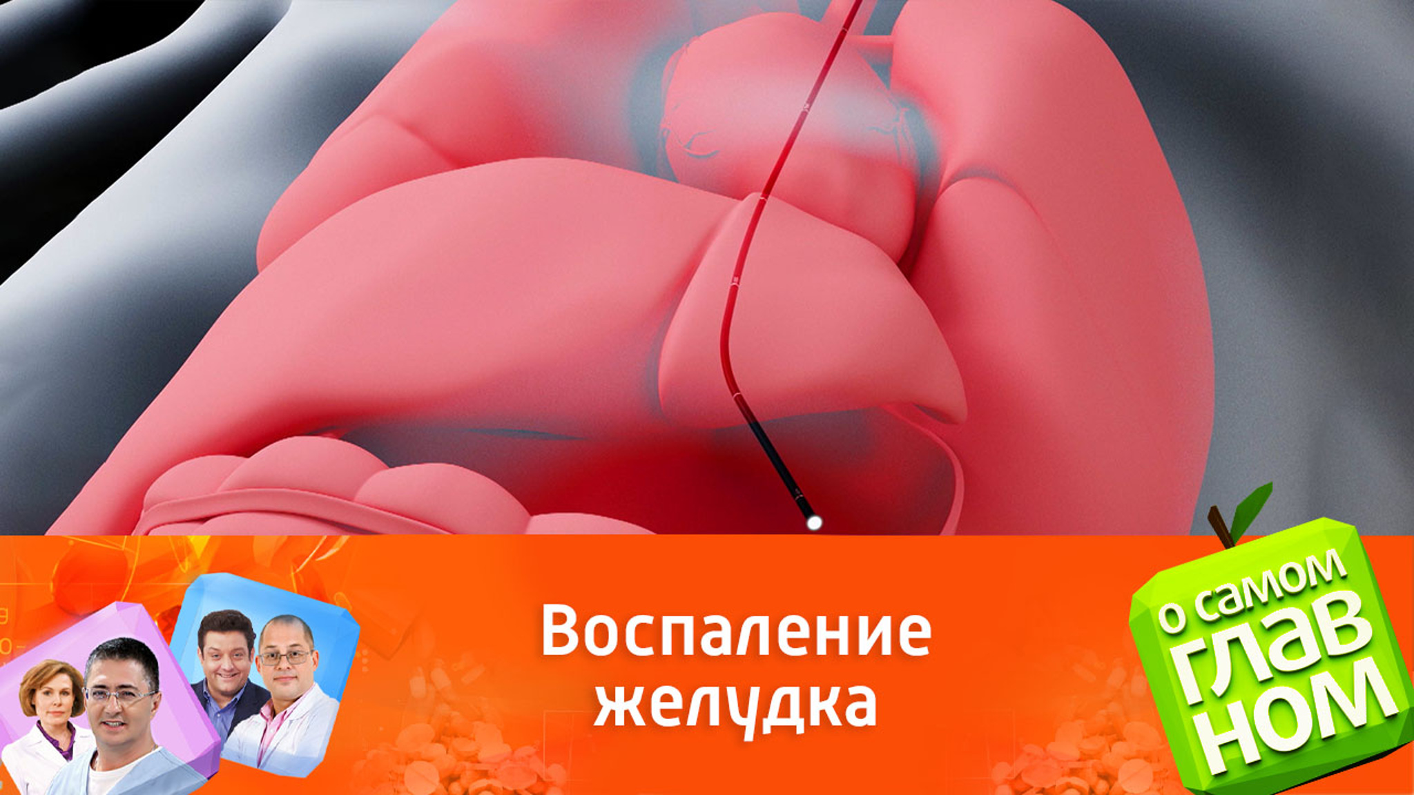 Доктор Карпенко: чувство тяжести и переедания – один из симптомов гастрита