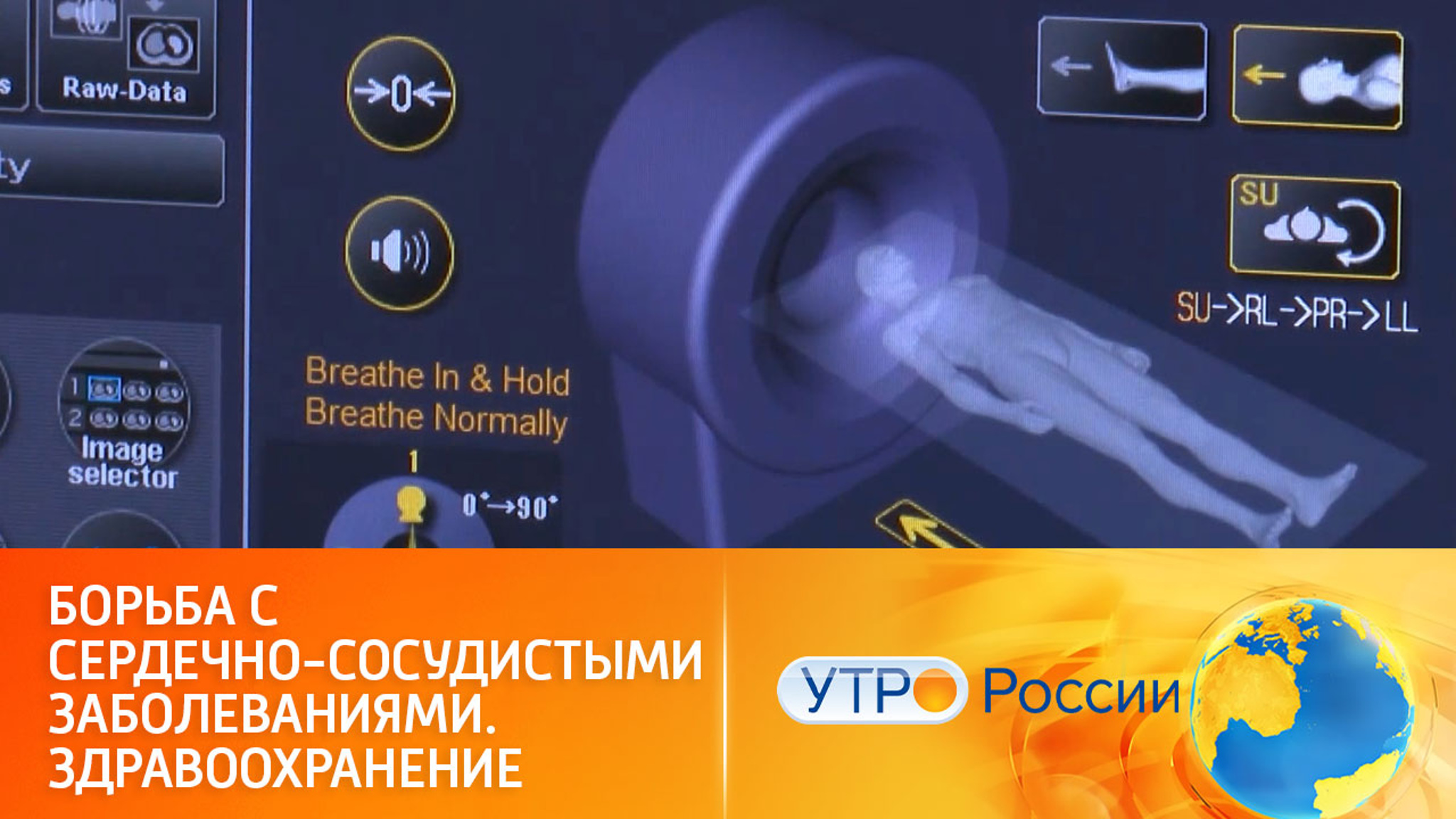 Борьба с сердечно-сосудистыми заболеваниями. Здравоохранение