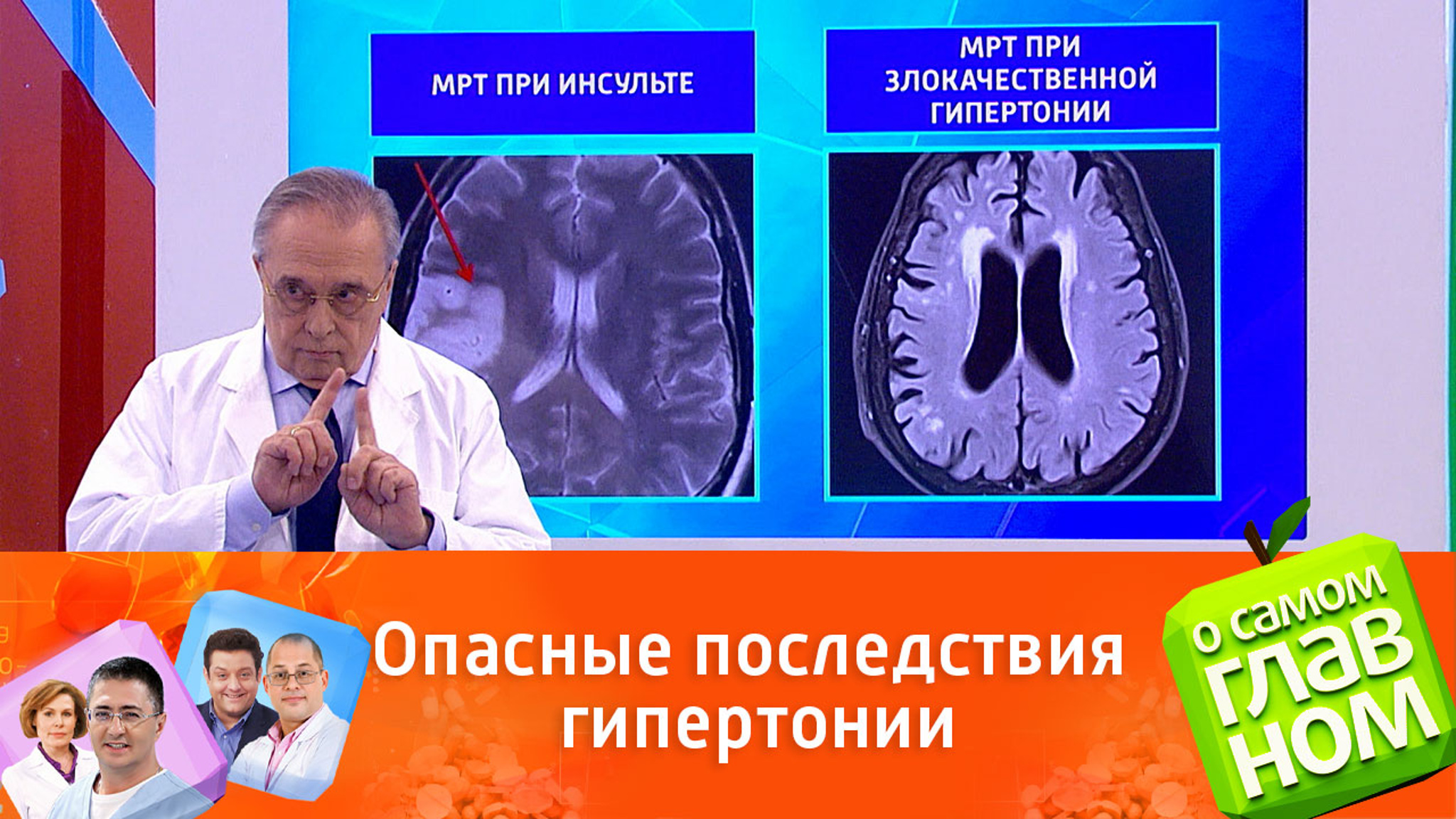 Длительная гипертония приводит к нарушению когнитивных функций