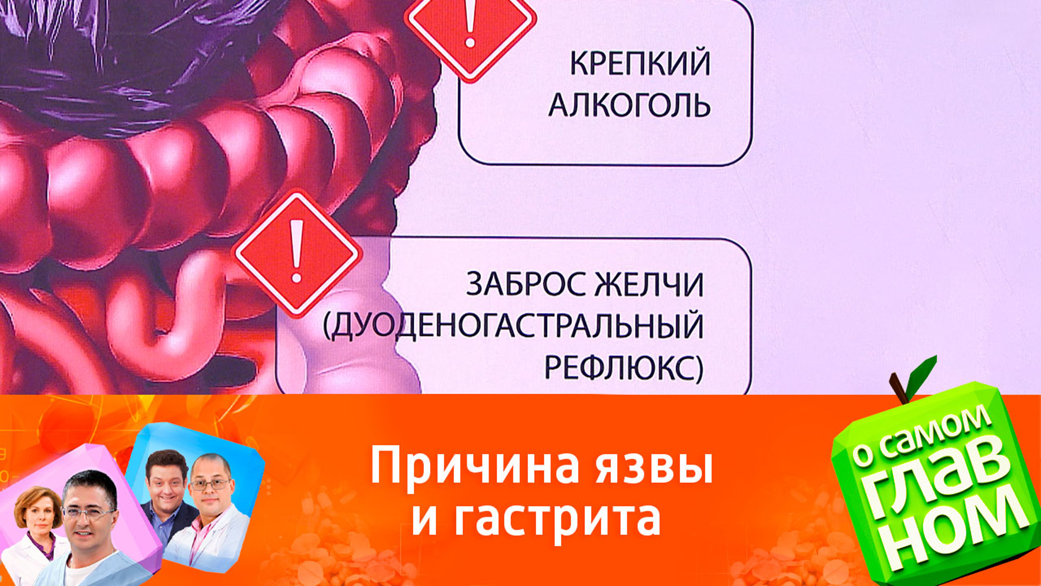 Противовоспалительные препараты провоцируют язву и гастрит