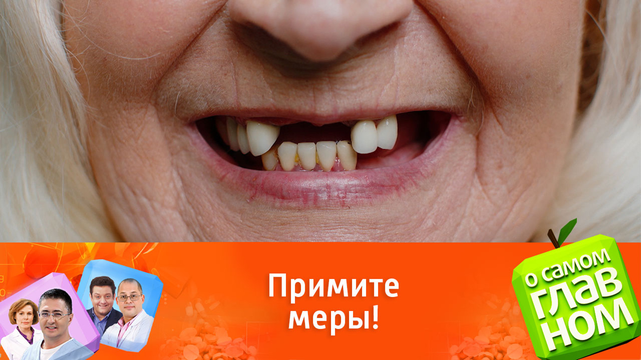 Диабет – это отчетливый путь к потере зубов