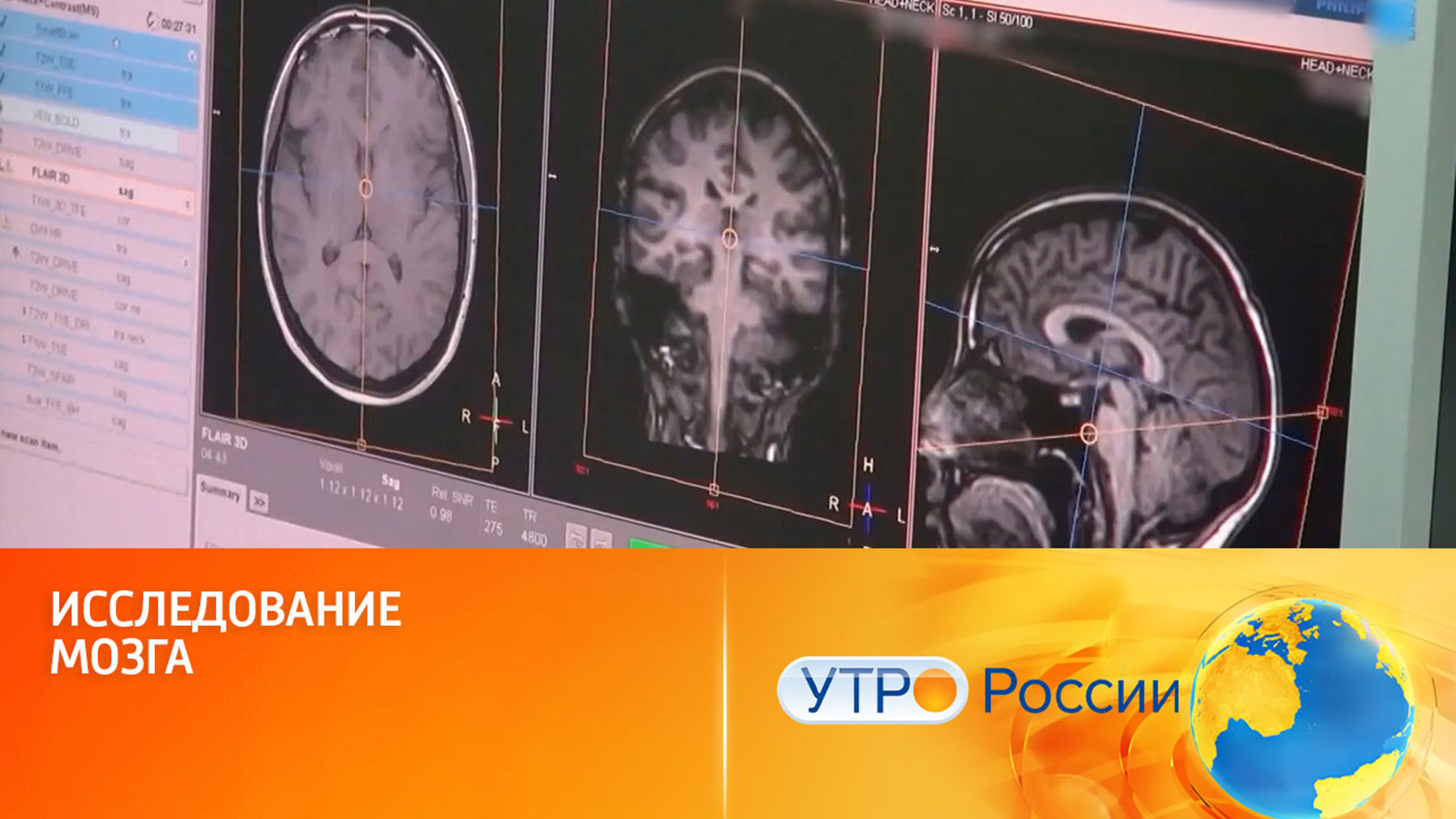 В Казани изучают тайны и возможности человеческого мозга