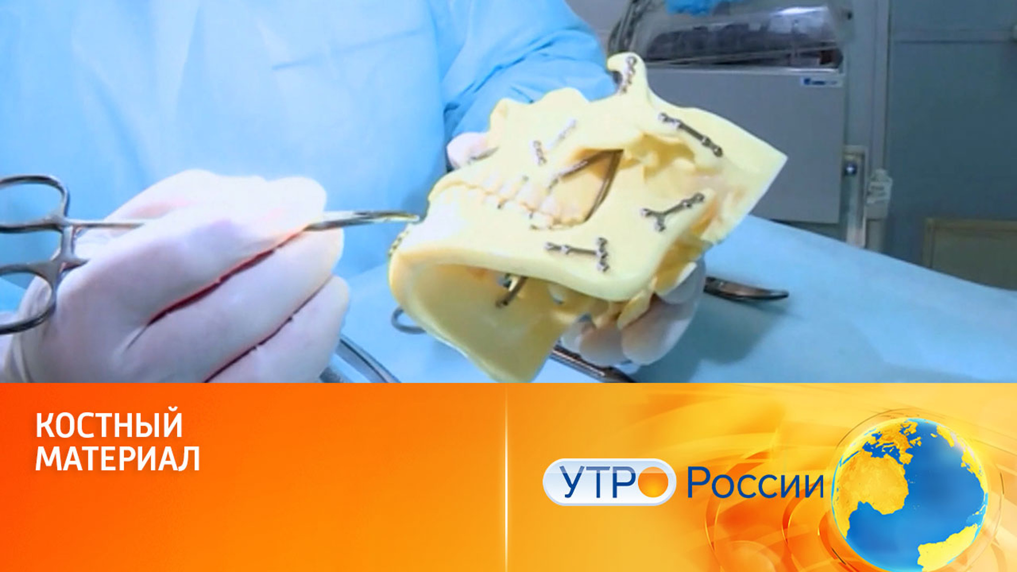 Новый костный материал: разработка российских ученых