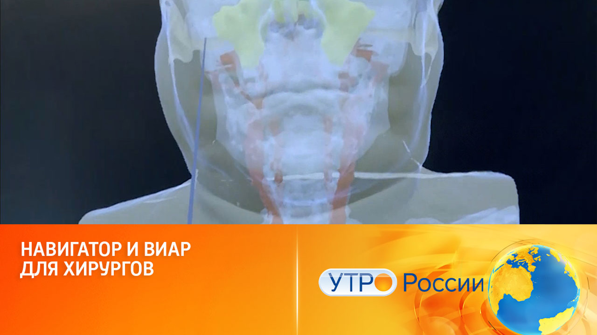 Российские специалисты разработали навигатор для хирургов