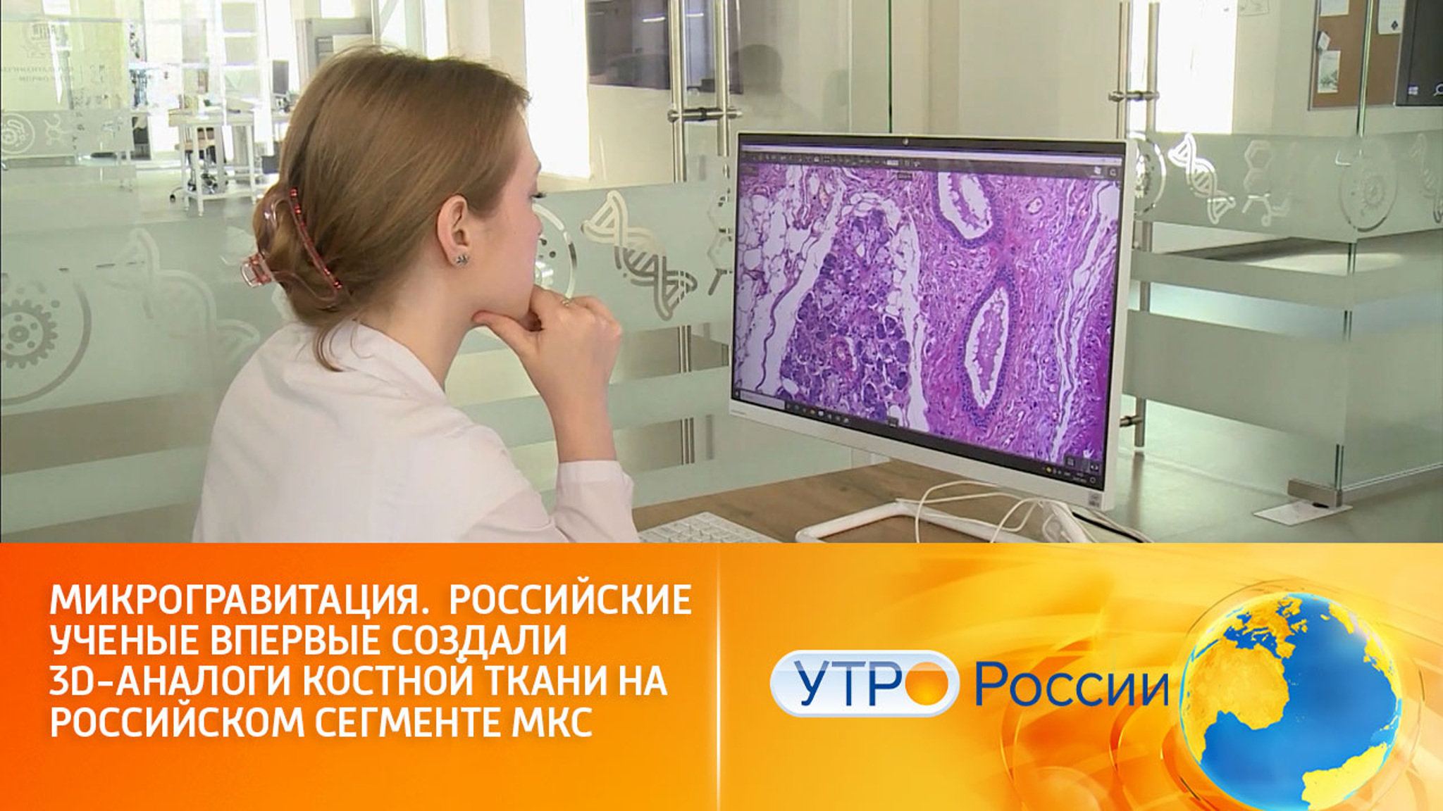 Российские ученые создали 3D-аналоги костной ткани на российском сегменте МКС
