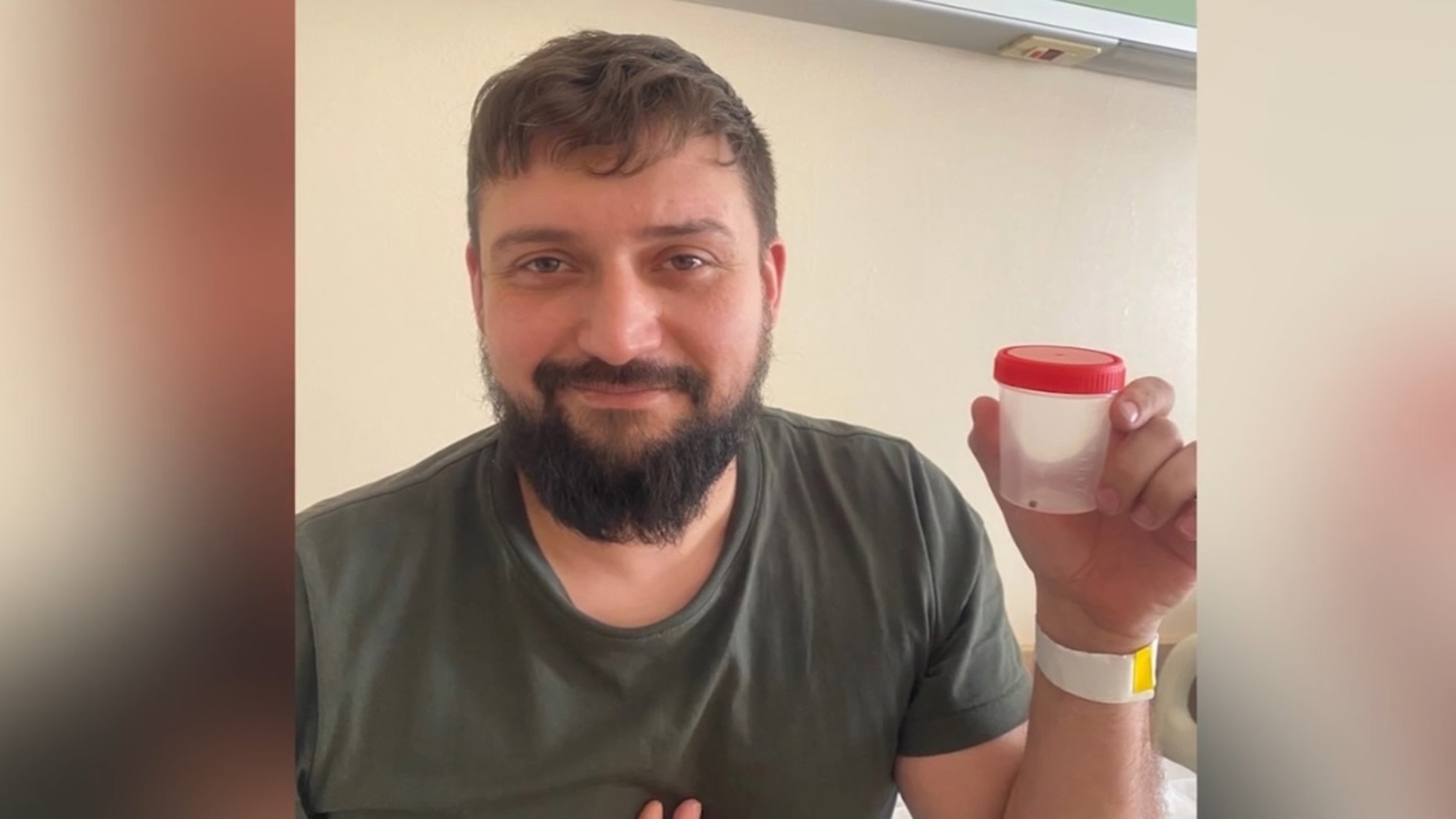 Бойца СВО с осколком в грудной клетке спасли тюменские хирурги