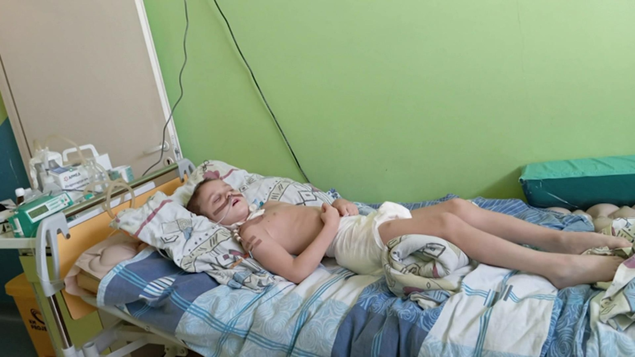 Челябинский школьник получил тяжелейшие травмы на батуте