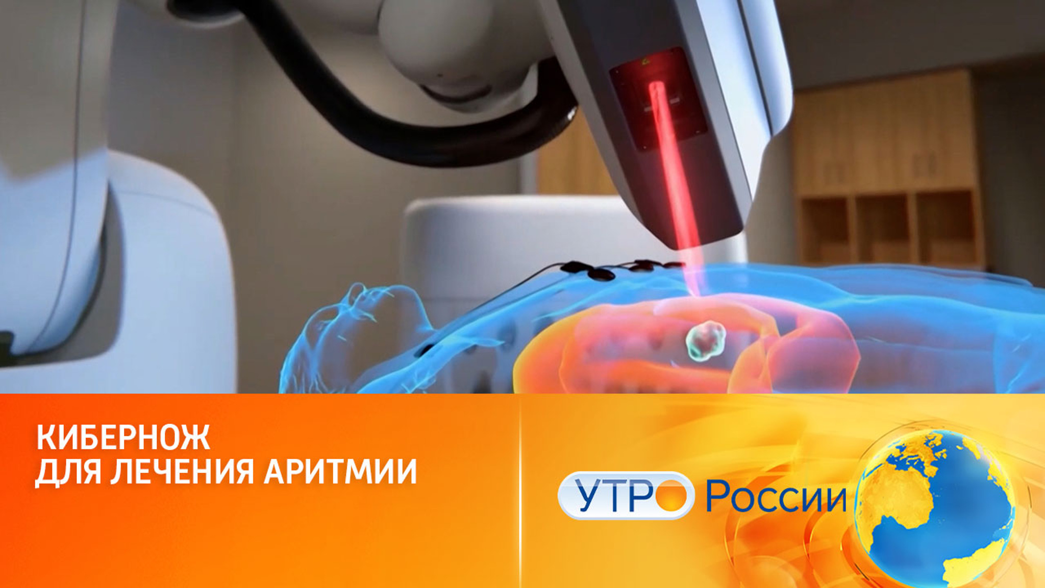 Кибернож для лечения аритмии