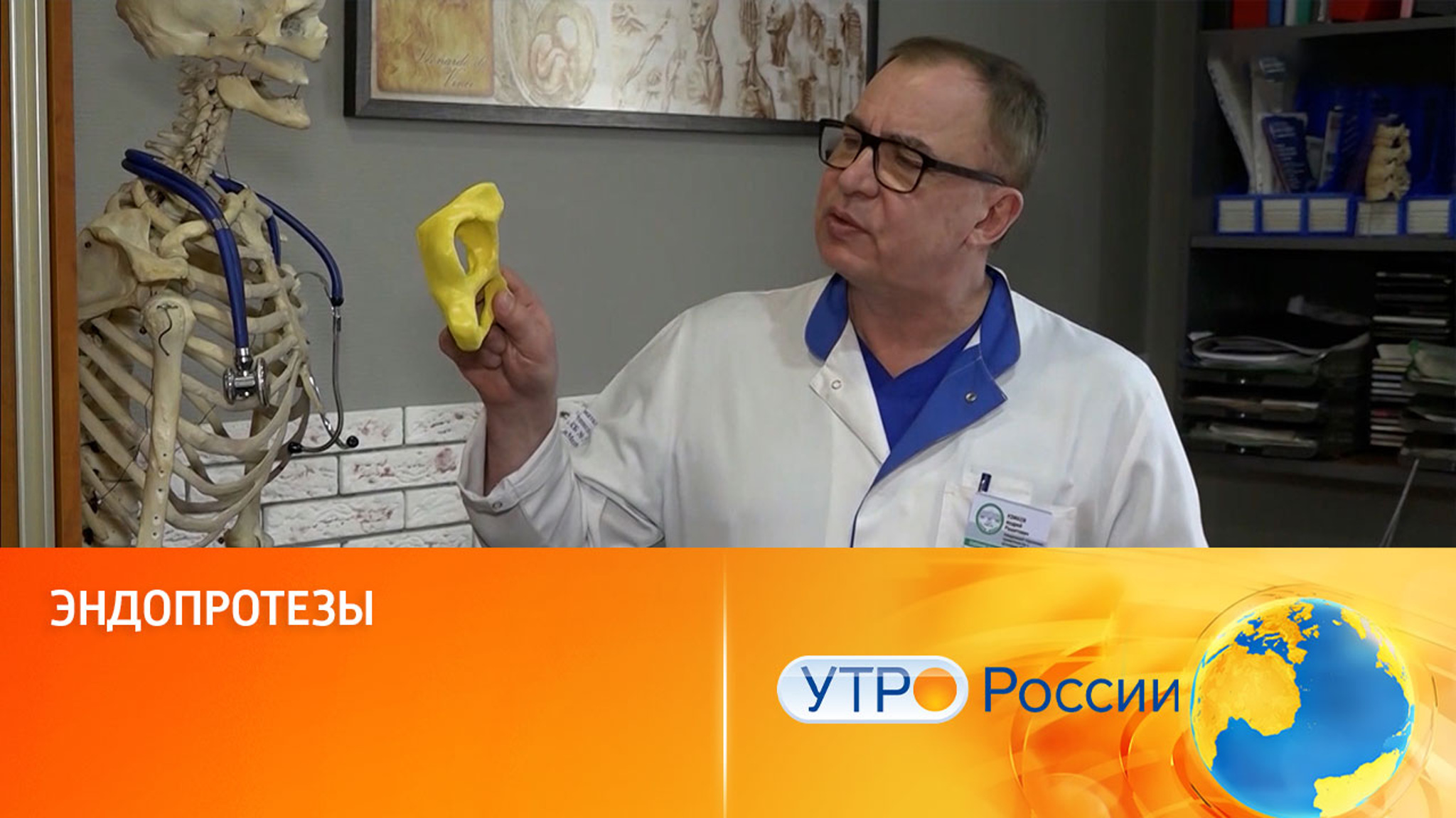 Эндопротезы