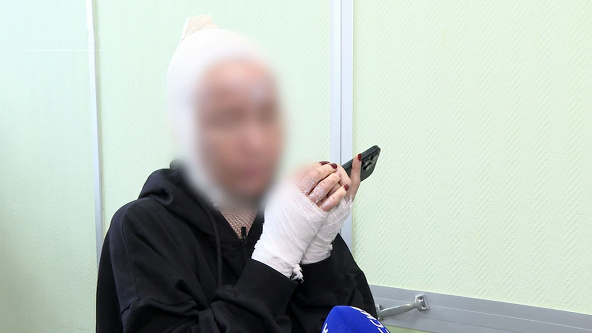 В Екатеринбурге многодетная мать стала жертвой кислотной мести