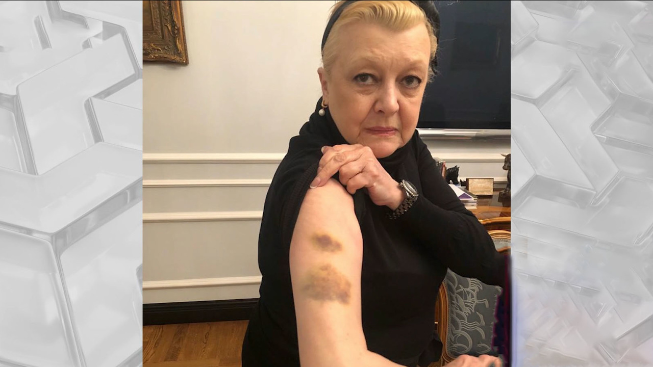 Павел Астахов: "Новость про избиение Дрожжиной очень интересная"