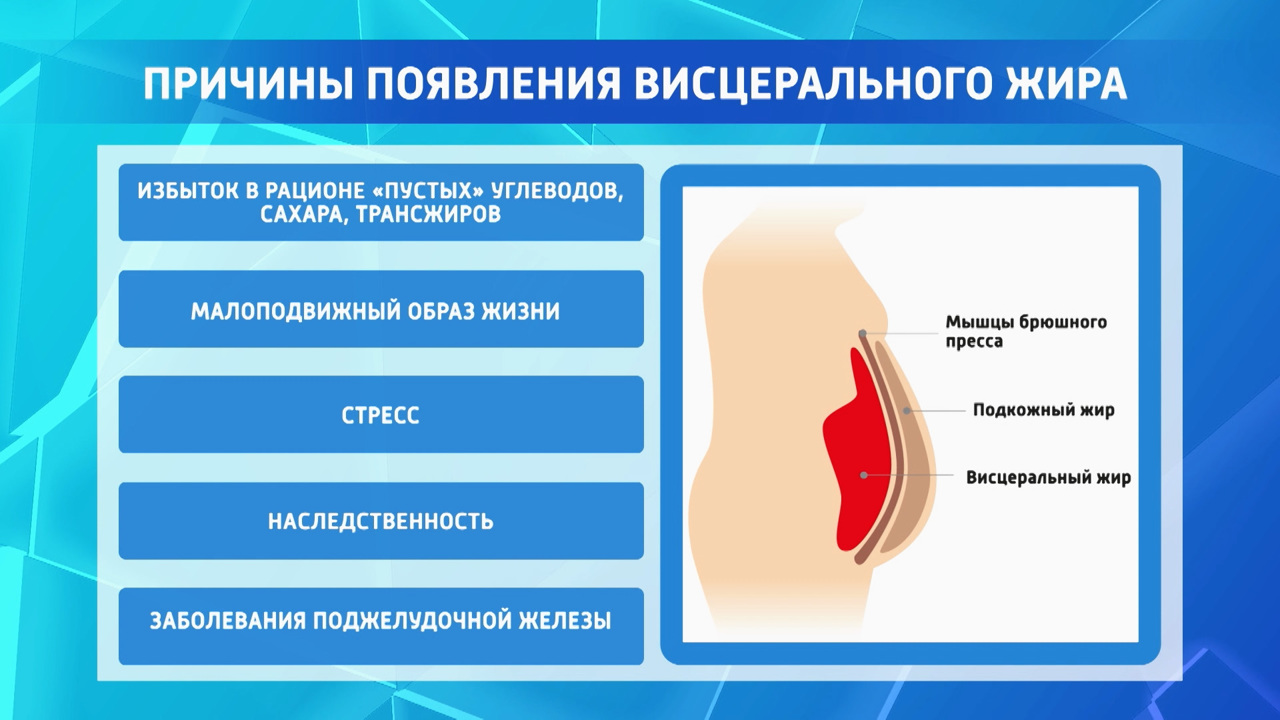 Как избавиться от лишнего на талии: эксперты о борьбе с висцеральным жиром