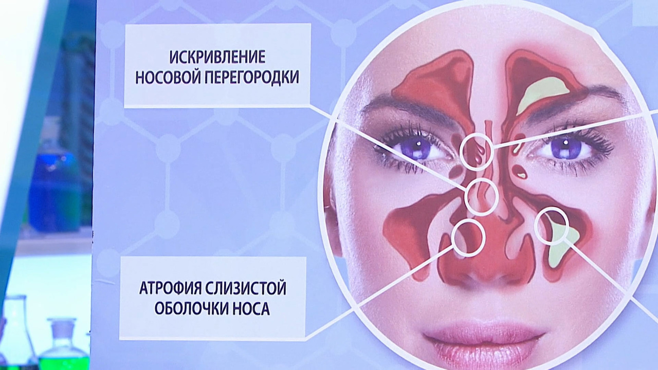 У кого могут возникнуть лор-осложнения при ОРВИ, гриппе и COVID-19