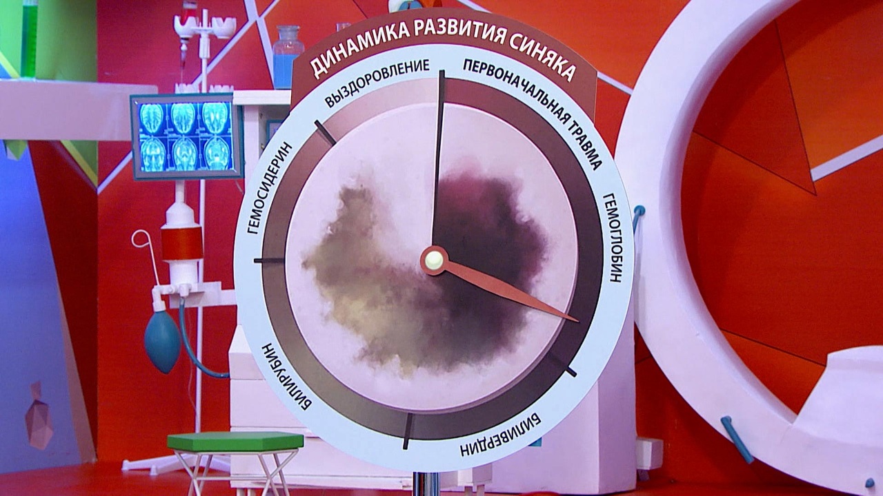 Когда синяк – симптом болезни. Мнение Александра Мясникова