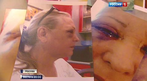 Кем убиты медсестры в Алеппо: Красный Крест равнодушен к смерти своих коллег