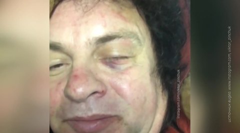  Гитарист Виктор Зинчук попал в аварию по дороге на концерт