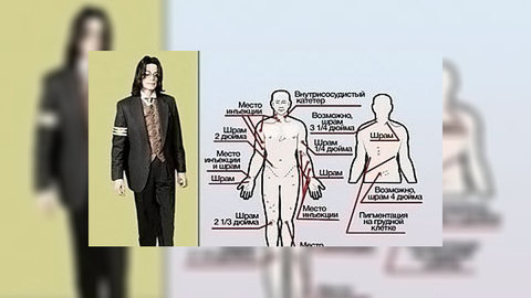 Врач Майкла Джексона будет защищаться "самоубийством"