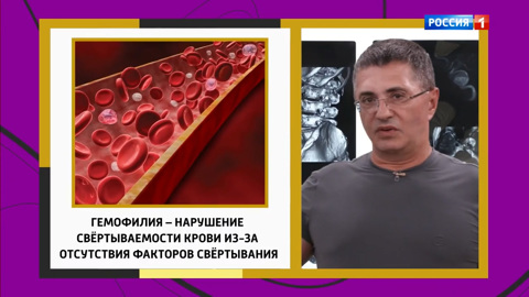 Как связаны синяки и боль в суставах, рассказал Мясников