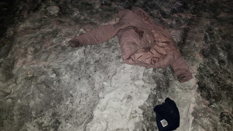 Возбуждено дело после смерти в больнице Кызыла покусанной собаками женщины