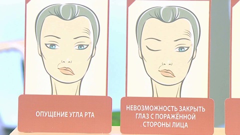 Как отличить паралич лицевого нерва от инсульта: советы доктора Мясникова