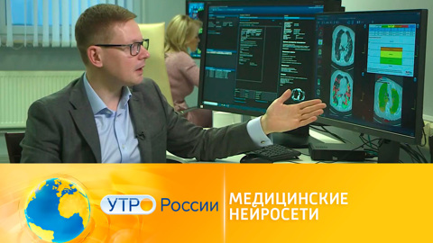Медицинские нейросети пришли на помощь врачам