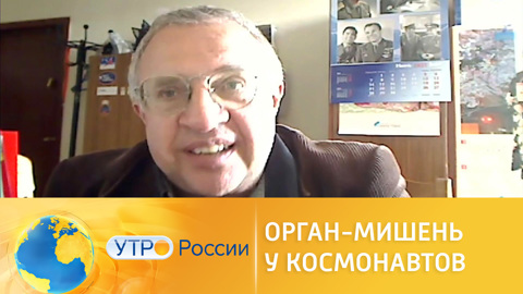 Здоровье космонавтов во время длительных полетов