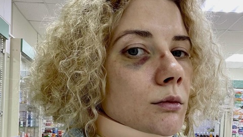 Звезда "Шаманки" Инна Коляда рассказала, кто жестоко избил ее