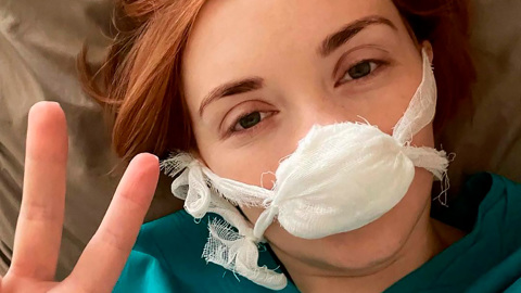 Ольга Кузьмина решилась на ринопластику, когда ее не взяли в космос