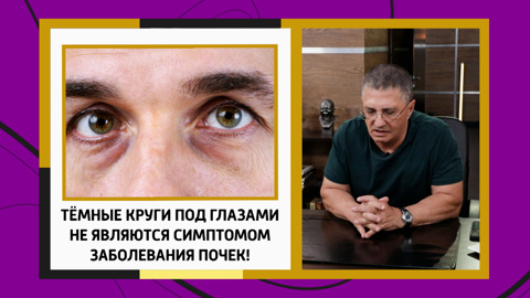 Александр Мясников развеял миф о темных кругах под глазами